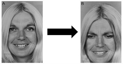 Electrophysiological and Behavioral Indices of the Role of Estrogens on Memory Processes for Emotional Faces in Healthy Young Women